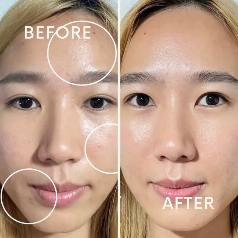 Before & After รีวิวการเปลี่ยนแปลงผิวจากผู้ใช้จริง